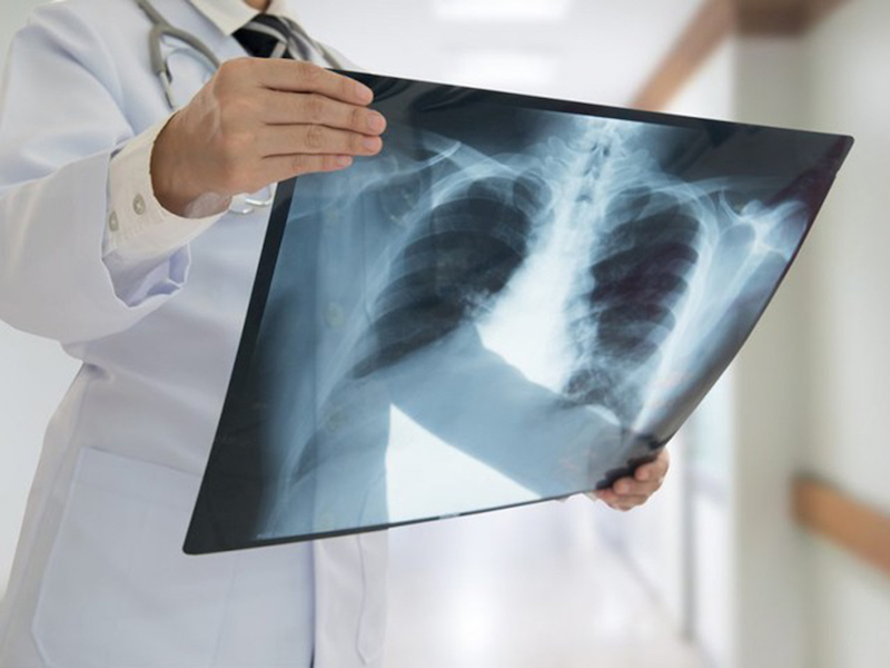 Рентген брюшной полости в Новосибирске в клинике Апекс