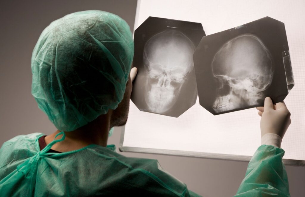 Сделать платный рентген головы в клинике Апекс в Новосибирске
