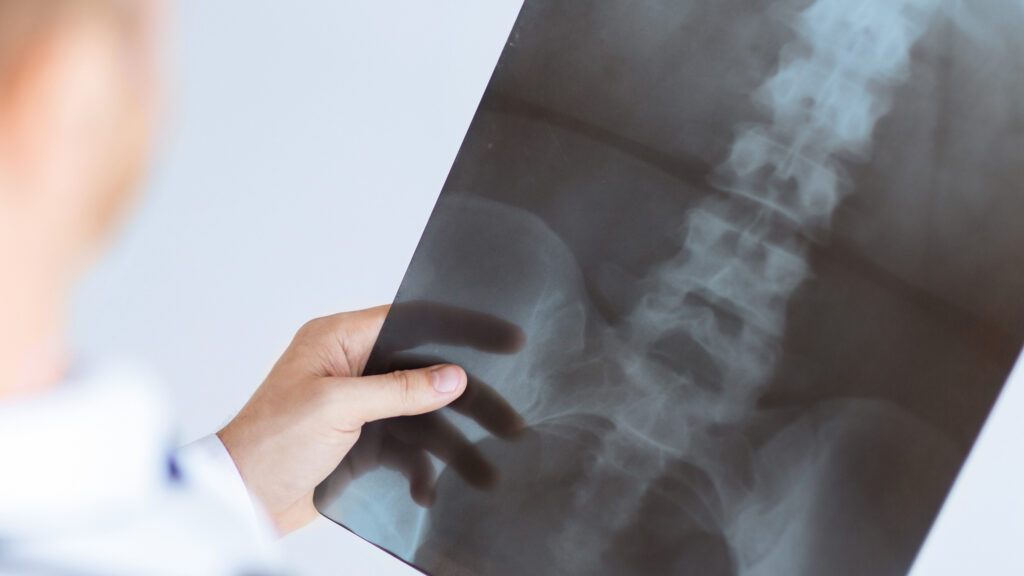 Цены на рентген пояснично-крестцового отдела позвоночника в клинике Апекс Новосибирска.
